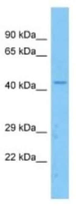 Apolipoprotein L5 Rabbit anti-Human, Polyclonal, Novus Biologicals 100